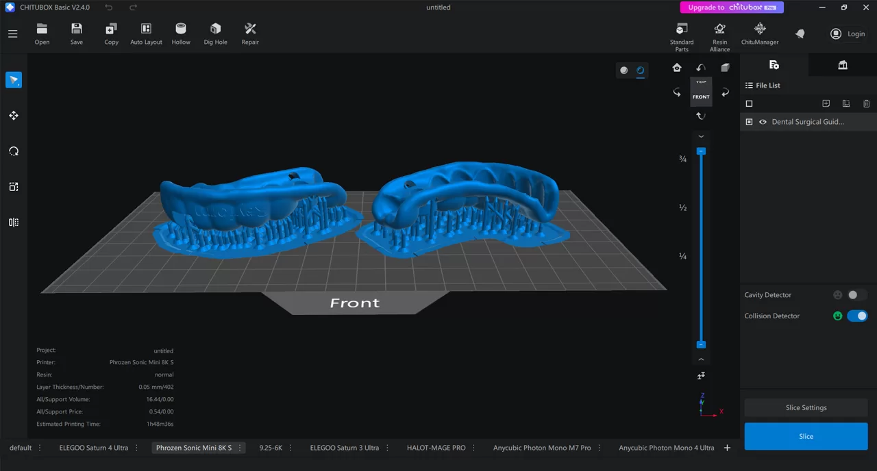 Dental Surgical Guide Model design