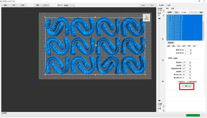 Automatic layout of dental model positions