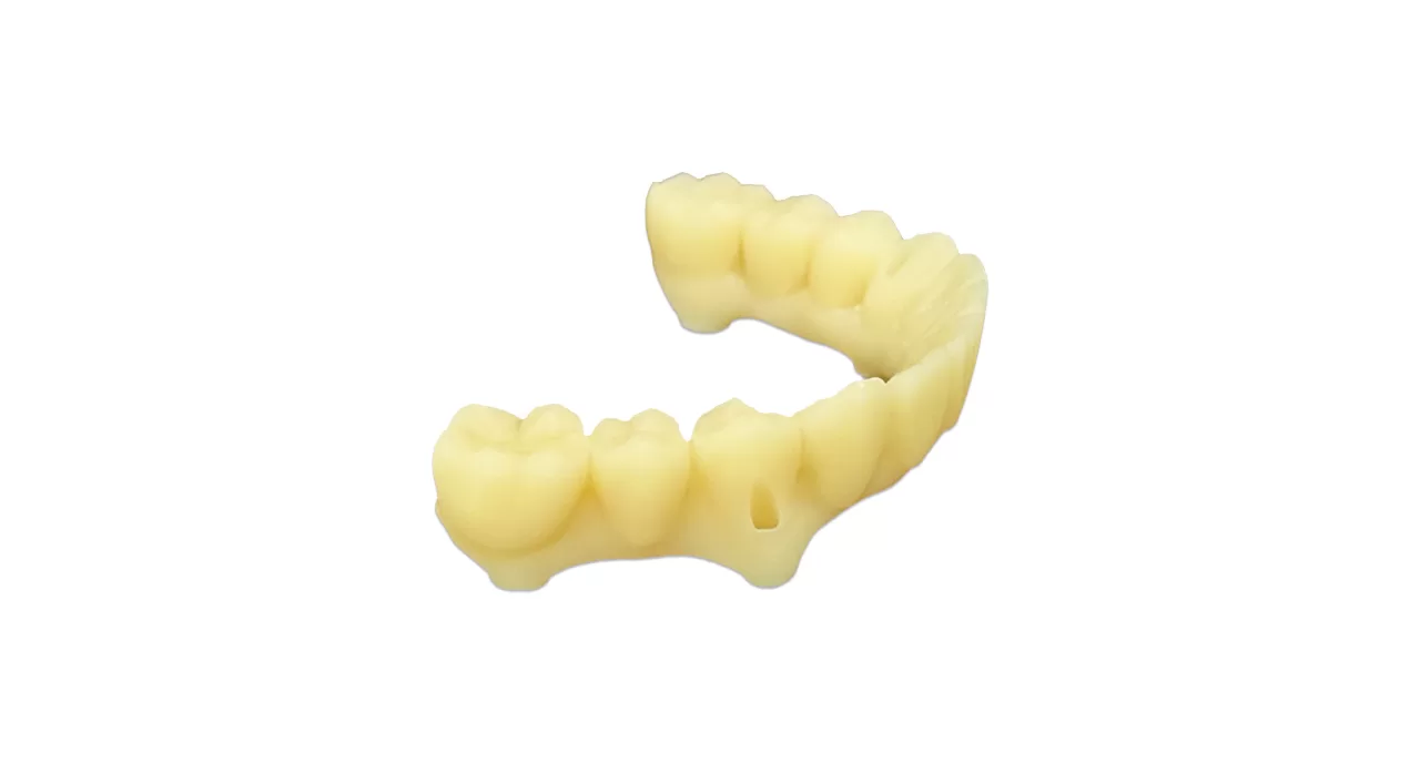 Based on oral scanning data, 3D printing can quickly produce temporary crowns that perfectly fit the prepared teeth, with an accuracy of up to the micrometer level, which is significantly superior to the traditional manual production method.