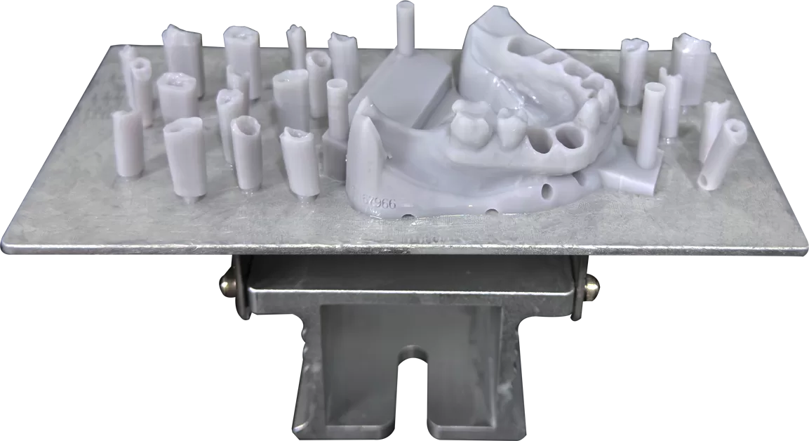 Got Full Mouth Implant Models