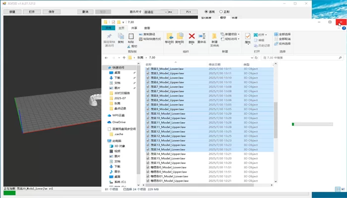 Import the dental model into the RayForm Software