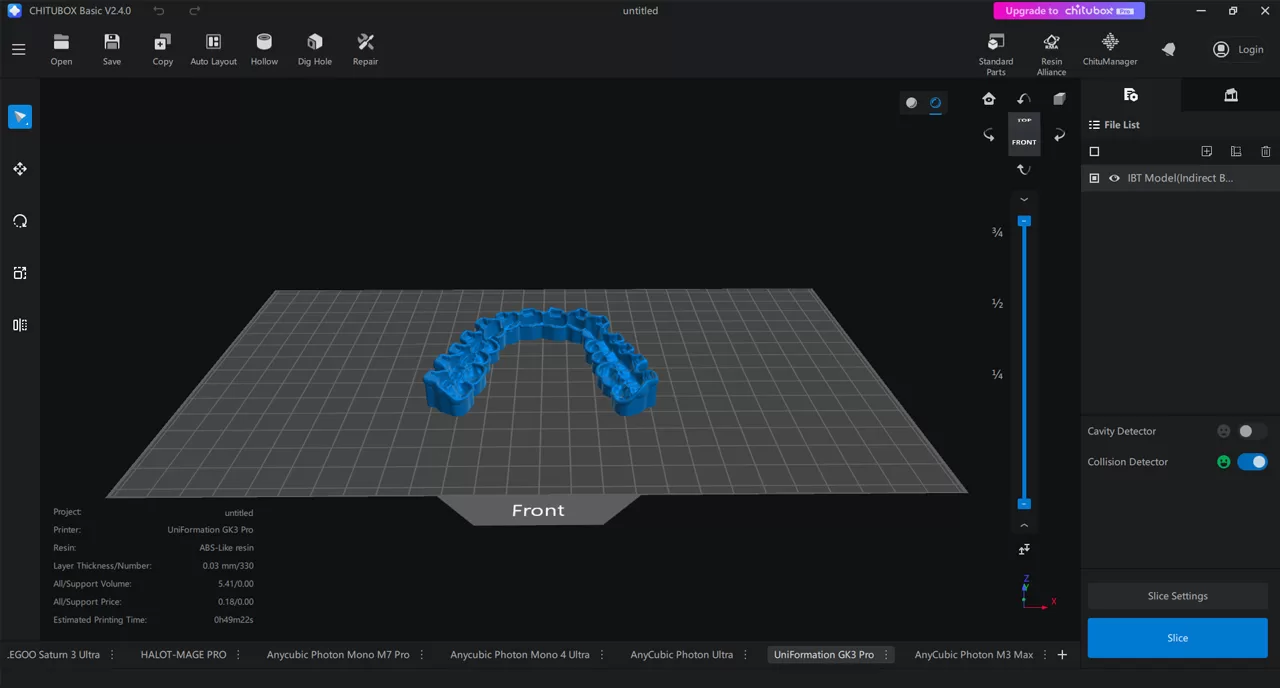 Indirect Bonding Tray Model design