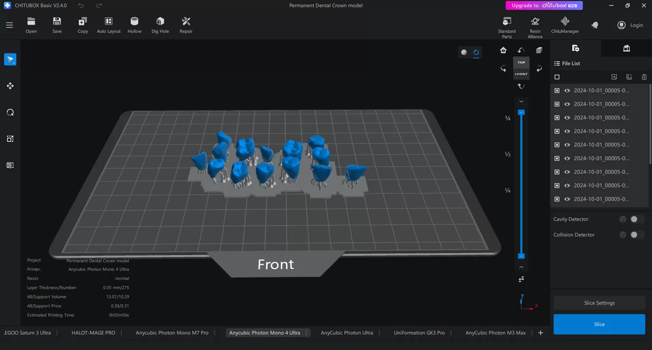 Permanent Dental Crown model design