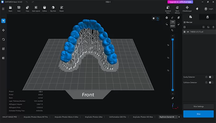 4D Clear Aligner model design by CHITUBOX_