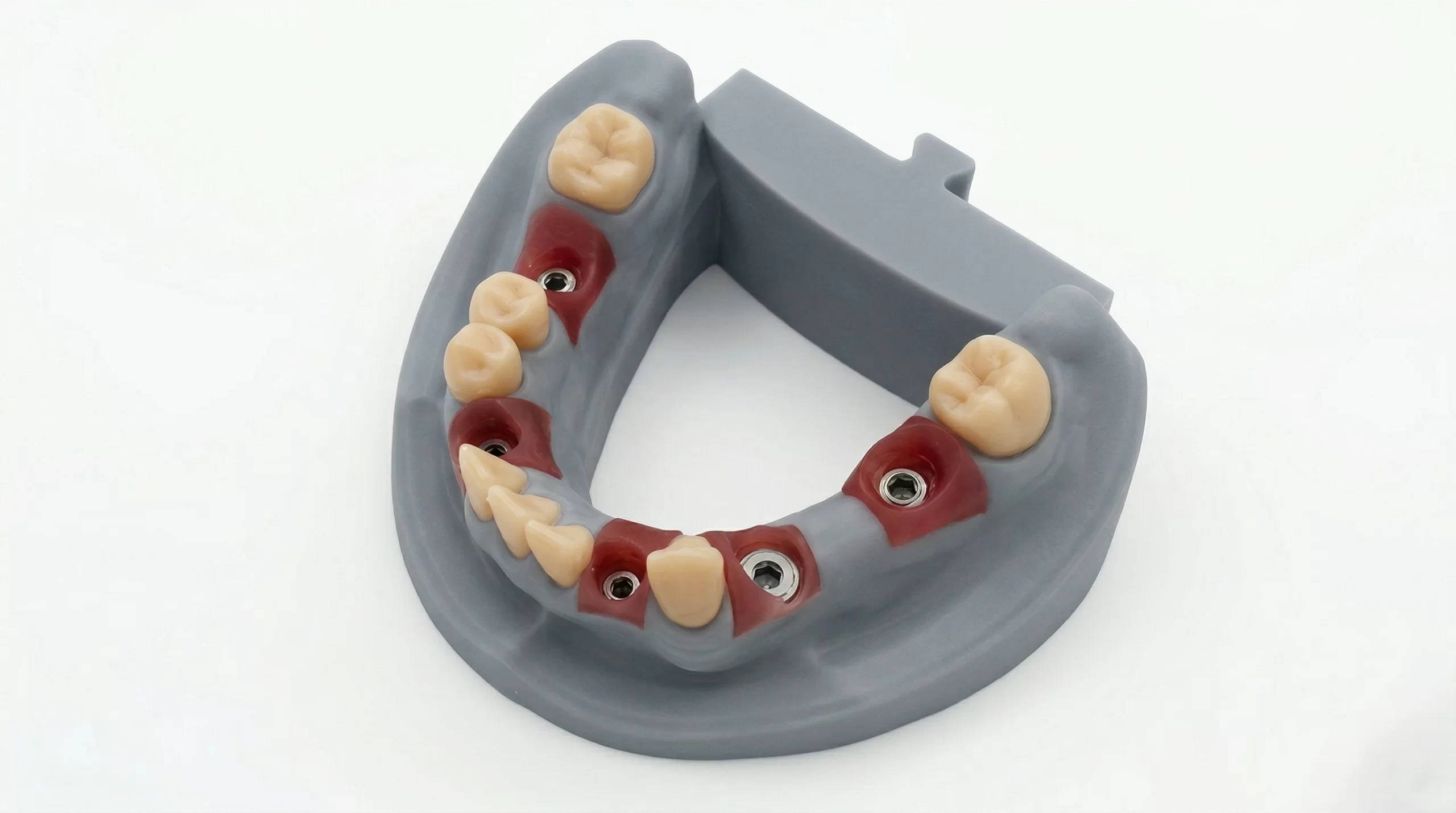 High Precision Implant Model Resin used in orthodontic and surgical guide production