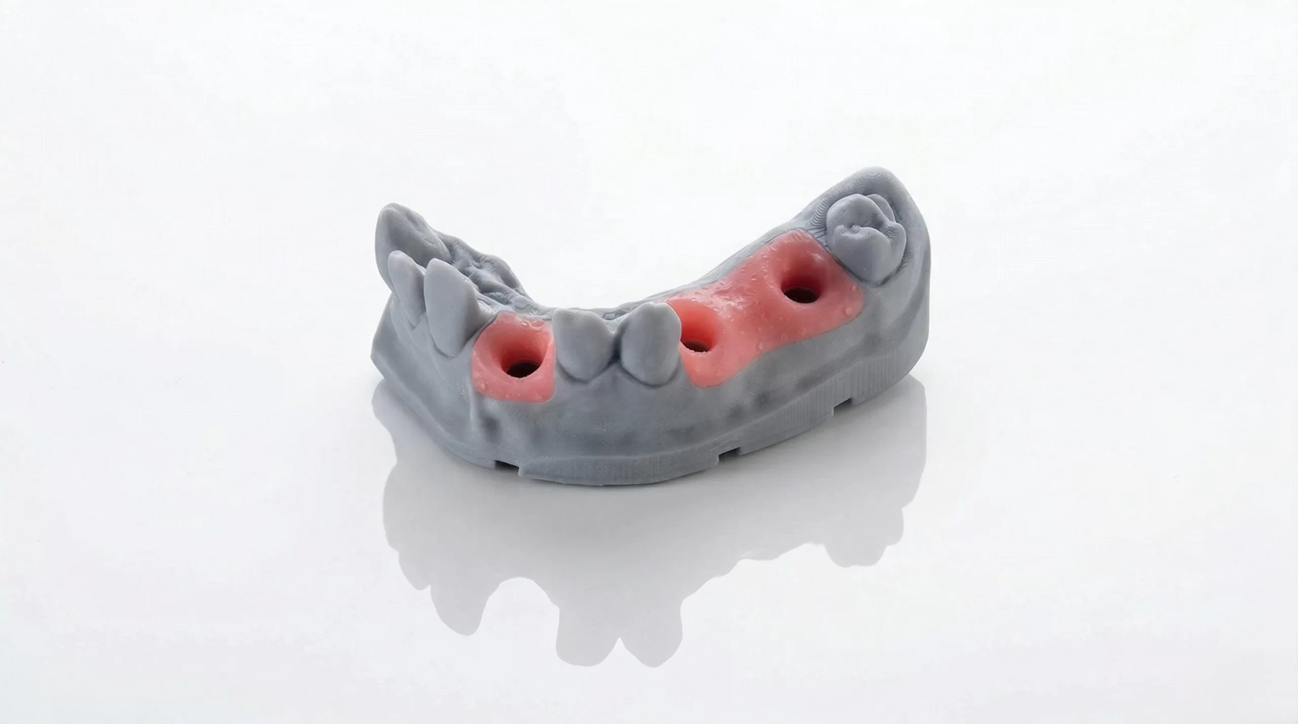 Gingiva Mask Resin application example