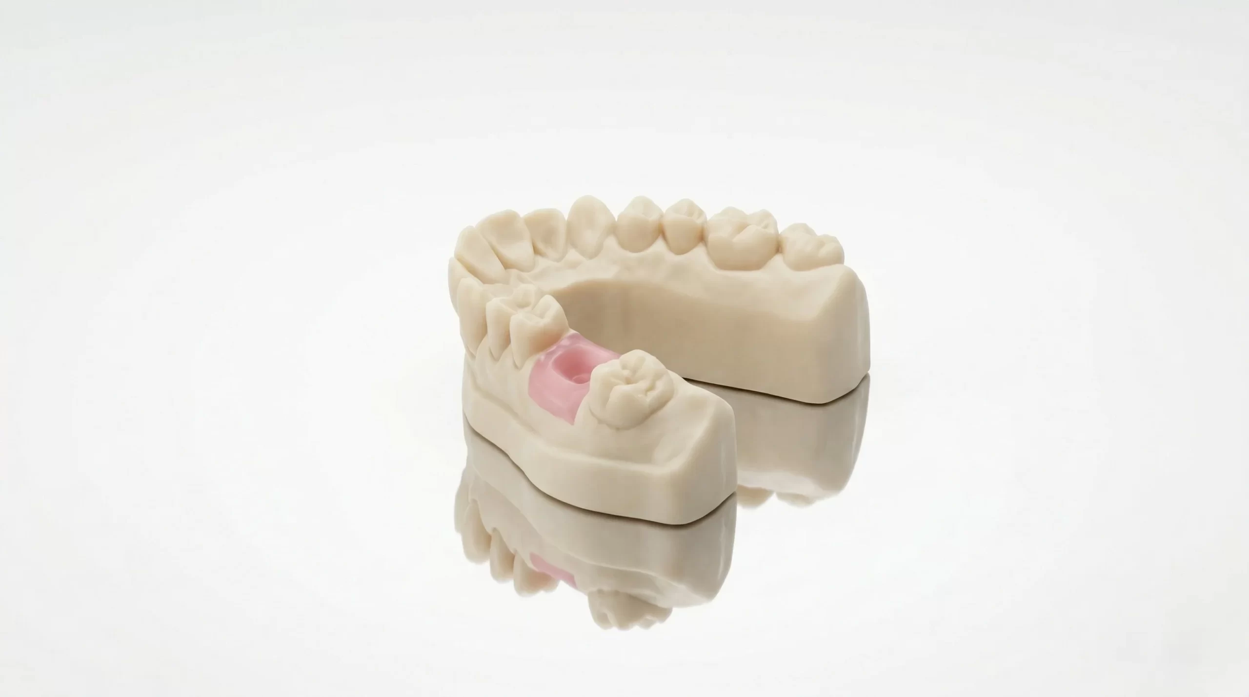 Gingiva Mask Resin clinical application