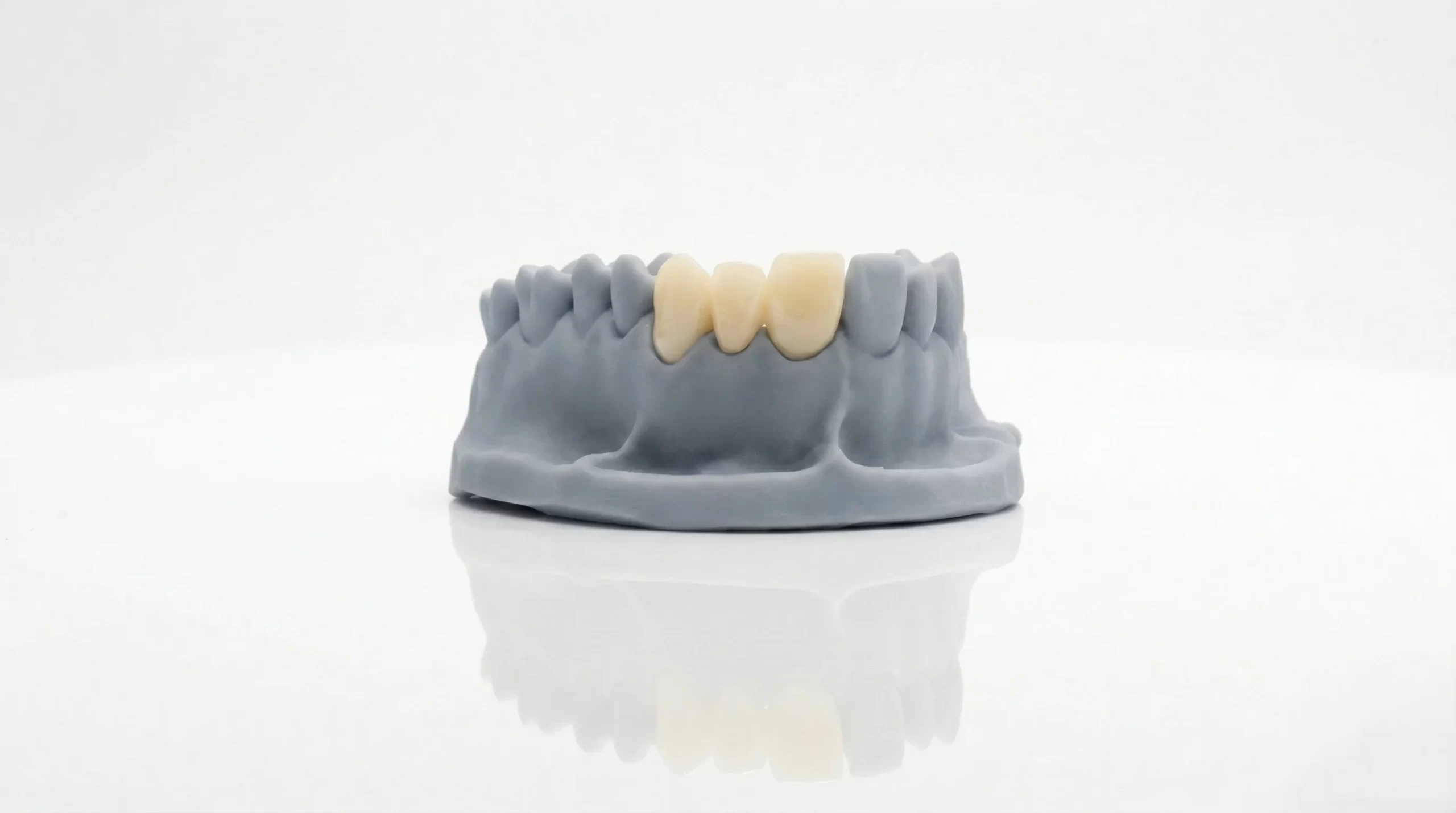 Temp C&B Resin clinical application