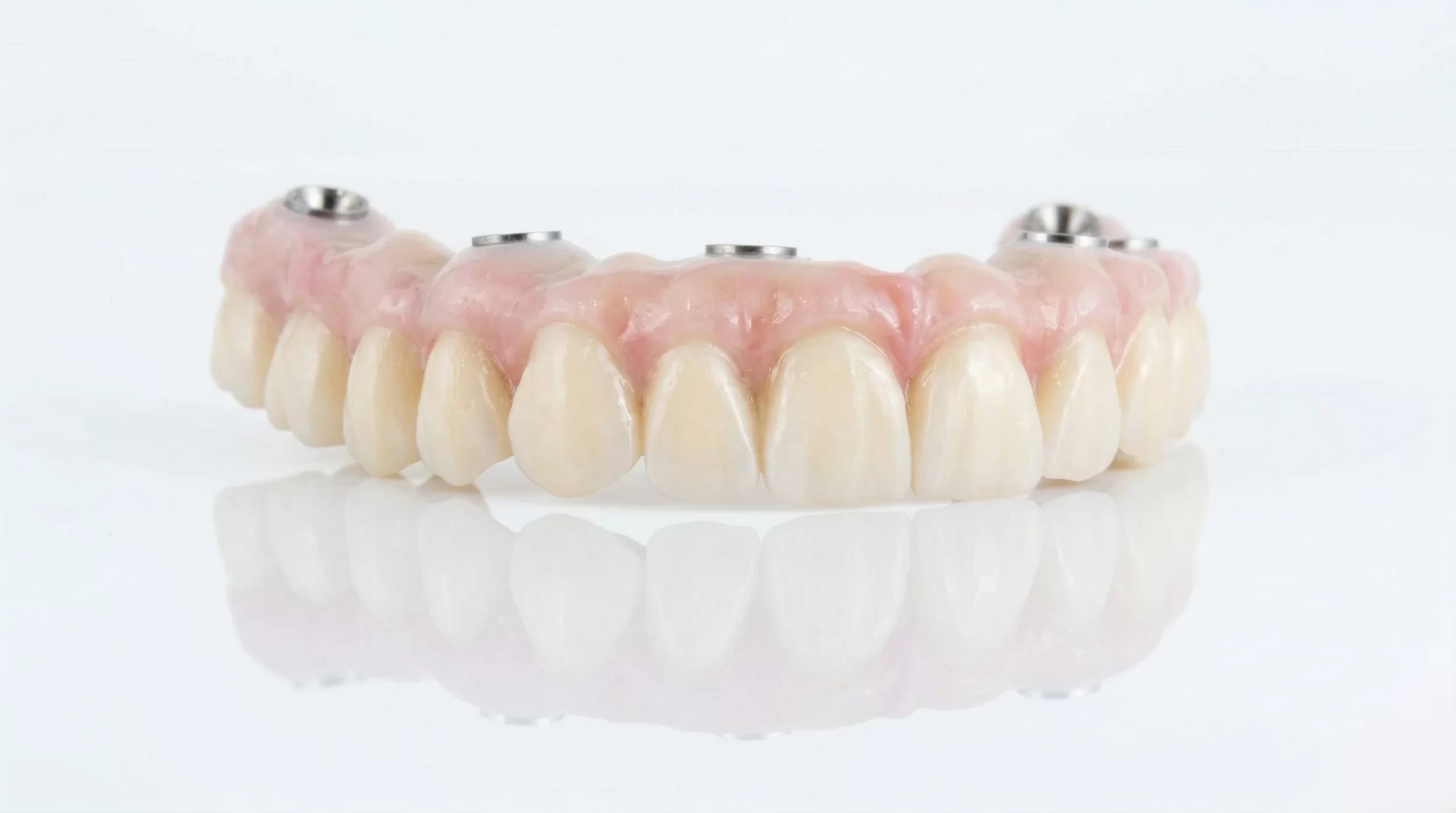 Fixed Hybrid Dentures Resin implant-supported restoration Fixed Hybrid Dentures Resin implant-supported restoration