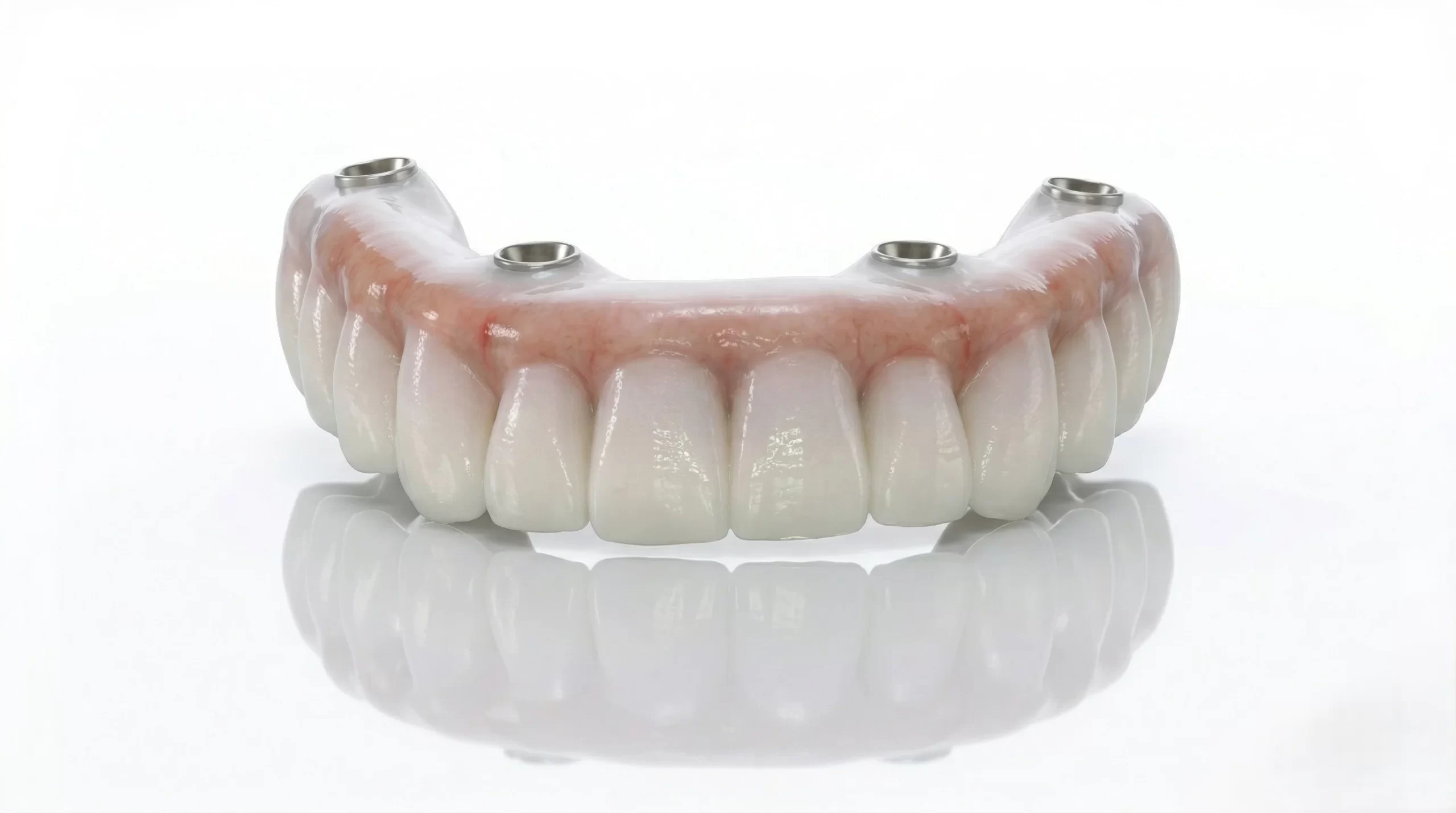 Fixed Hybrid Dentures Resin full-arch prosthetic
